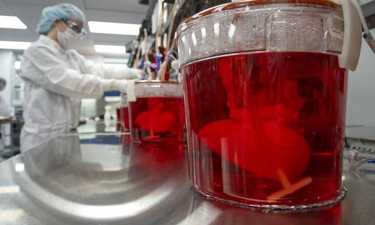 Shitën veshkat e emigrantëve për 9000 euro, 12 të arrestuar