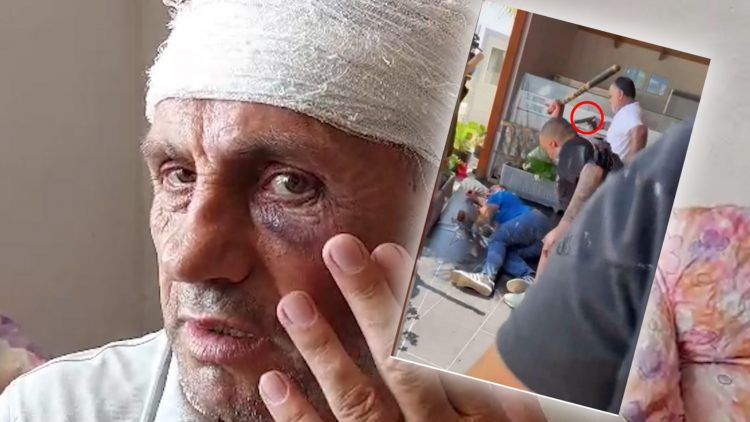 Sherri i dhunshëm për guroren në Borizanë/ Flet vëllai i një prej të plagosurve: Xhelal Rraja ishte me armë në dorë