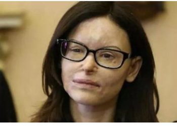 I hodhi acid në fytyrë avokates italiane, shqiptari del nga burgu pas 9 vitesh