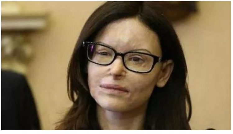 I hodhi acid në fytyrë avokates italiane, shqiptari del nga burgu pas 9 vitesh