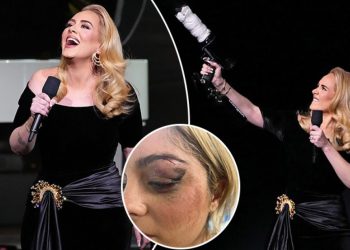 “Mos guxoni se do t’ju vras”, Adele ndërpret koncertin dhe u kthehet fansave…