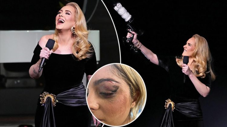 “Mos guxoni se do t’ju vras”, Adele ndërpret koncertin dhe u kthehet fansave…