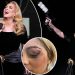 “Mos guxoni se do t’ju vras”, Adele ndërpret koncertin dhe u kthehet fansave…