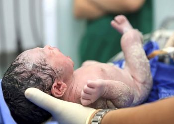 Të lindësh me “këmishë”, mjeku ndan pamjet nga fenomeni i rrallë në Tiranë (VIDEO)