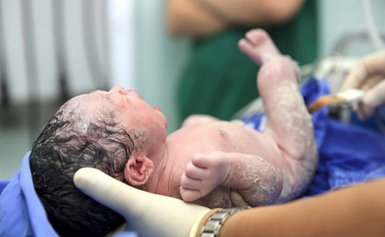 Të lindësh me “këmishë”, mjeku ndan pamjet nga fenomeni i rrallë në Tiranë (VIDEO)