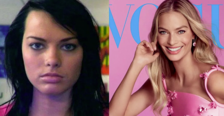 Sa operacione plastike ka bërë Robbie për të arritur pamjen e ‘Barbie