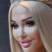 Fitoi çmimin e parë si miss, shpërthejnë kritikat ndaj modeles: Duhet të fitonte kirurgu i saj plastik