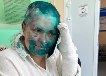 Gazetarja dhe avokati i njohur rrihen keq nga grupi i armatosur