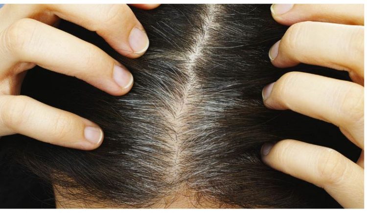 Ja si të shmangni thinjat e parakohshme të flokut