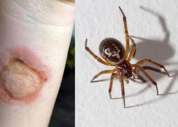 Merimanga helmuese, shtohen rastet e pickimit nga “vejusha e zezë”