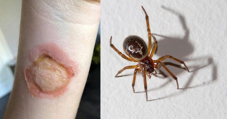 Merimanga helmuese, shtohen rastet e pickimit nga “vejusha e zezë”