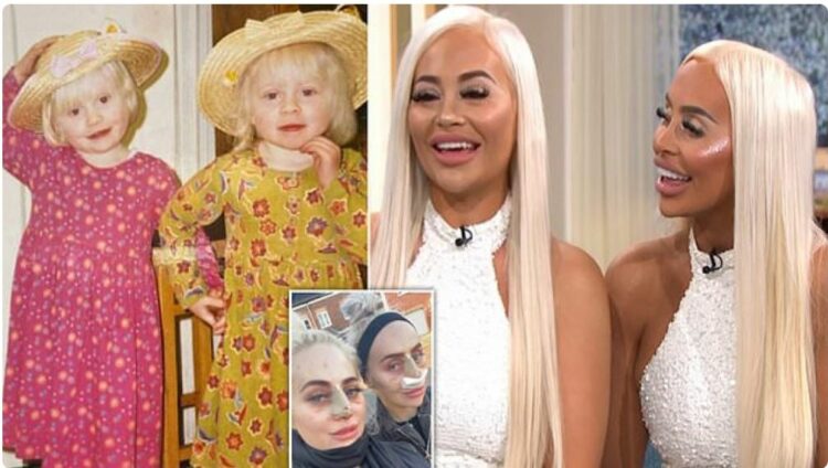 Binjaket shpenzojnë 186 mijë euro për t’u dukur si Barbie