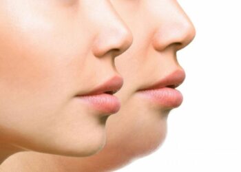 Këshillat si të largoni ‘gushën e varur’