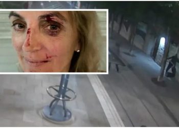 Një mjeke sulmohet në rrugë, policia publikon pamjet