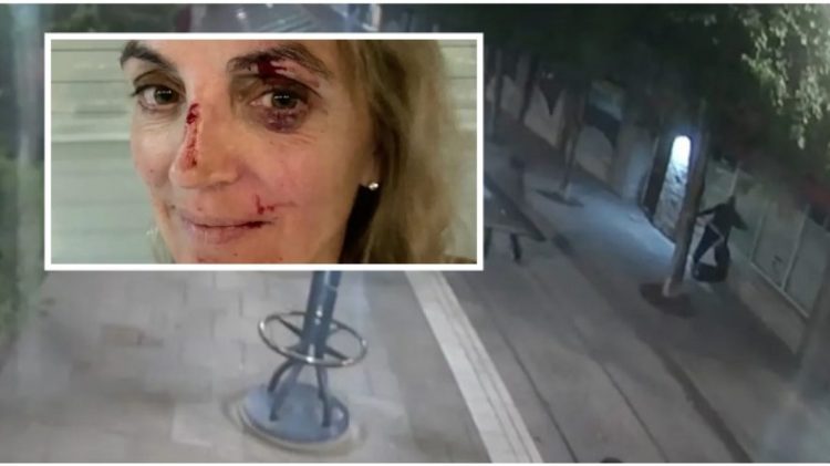 Një mjeke sulmohet në rrugë, policia publikon pamjet