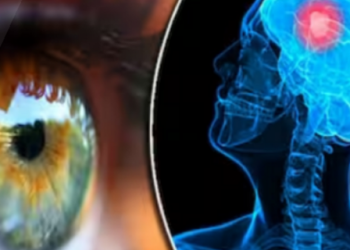 10 shenja që tregojnë se keni një tumor në tru