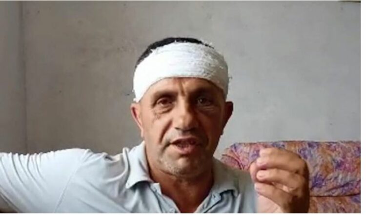 U dhunua barbarisht nga Rrajat, Jashar Maja: Mund të vdisja