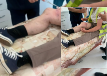 Qentë e rrugës sulmojnë punonjësen e pastrimit