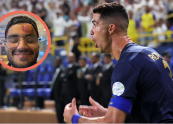 Goditja e tmerrshme e Ronaldos që bëri kameramanin ‘për spital’