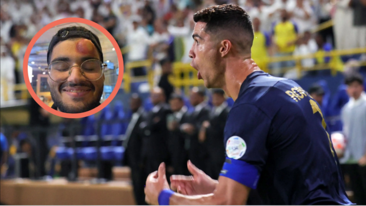 Goditja e tmerrshme e Ronaldos që bëri kameramanin ‘për spital’