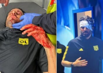 Nëntë të arrestuar për sulmin ndaj trajnerit të Lionit në Marsejë