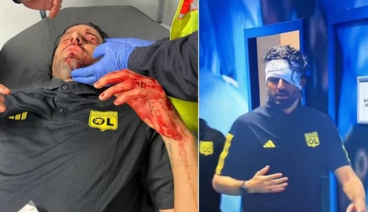 Nëntë të arrestuar për sulmin ndaj trajnerit të Lionit në Marsejë