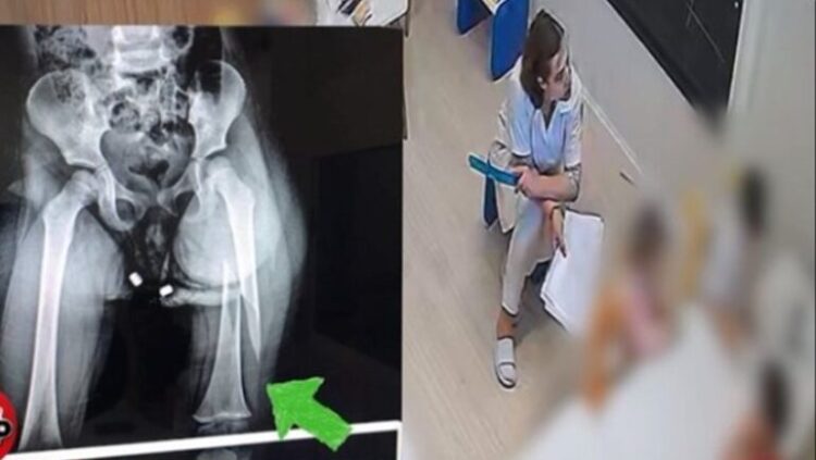 Dhunoi 3-vjeçaren, edukatorja s’ndryshon qëndrim: Këmbën e dëmtoi…