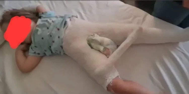 Tiranë/ Edukatorja i thyen këmbën fëmijës 3 vjeç, manipulohet ngjarja