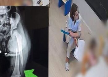 Dhunimi i 3-vjeçares në kopsht, AMP çon në prokurori dy policët