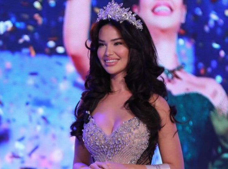 Miss Universe/ Ja ku renditet bukuroshja shqiptare Endi Demneri