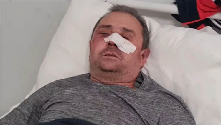 U bë për spital nga hajdutët, 54-vjeçari: Më goditën me qytën e armës