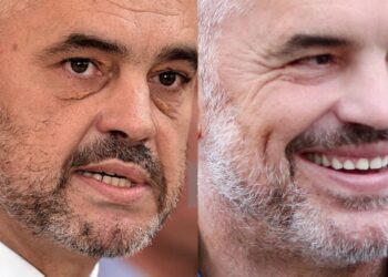Edi Rama ka bërë ndërhyrje estetike?! Mjekja nxjerr të vërtetën…