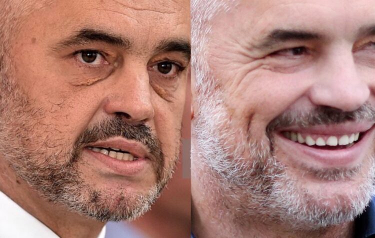 Edi Rama ka bërë ndërhyrje estetike?! Mjekja nxjerr të vërtetën…
