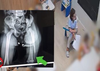 Edukatorja e kopshtit dhunoi 3-vjeçaren, qytetarët njoftojnë protestë