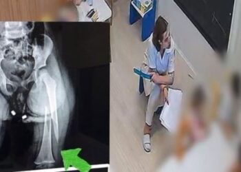 Dhunoi 3-vjeçaren, shoqërohet në polici edukatorja e kopshtit privat