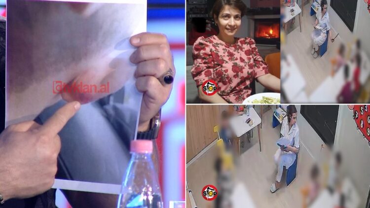 Denoncimi i ri/ Si ia mavijosi sanitarja veshin djalit