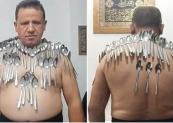 Një iranian thyen rekordin, vendos 88 lugë të balancuara në trup