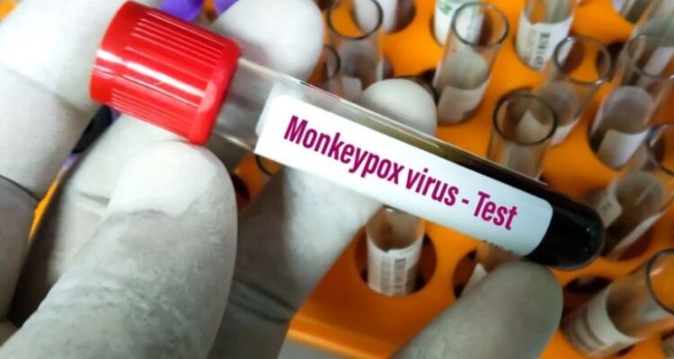 Shënohet viktima e parë nga lija e majmunit në Japoni