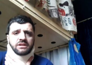 E dhunuan në burgun famëkeq grek, ja çfarë thotë shqiptari nga qelia