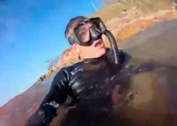 Video pas sulmit të peshkaqenit, i riu: Nuk mendoja se do të jetoja