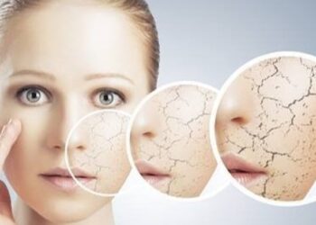 A e dinit? Ja çfarë e bën lëkurën tonë të duket më e vjetër në dimër