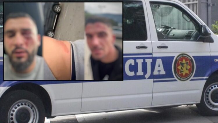 Dhunimi i shqiptarëve, reagon Unioni Demokratik në Mal të Zi