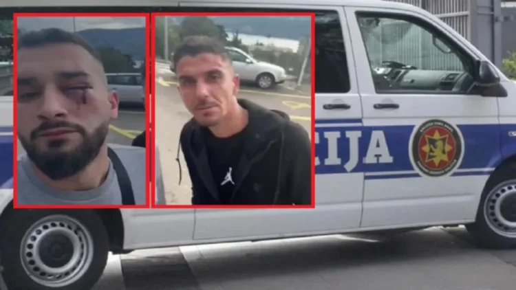 Dëshmia e Klodian Meajt: Sapo dolëm nga makina na goditën dhe…