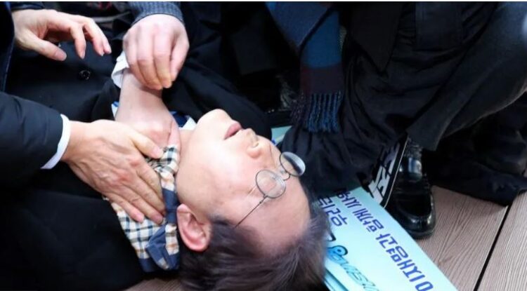 Pamje të rënda, goditet me thikë në qafë drejtuesi i opozitës