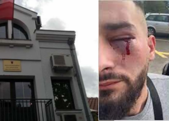 Tre shqiptarë u dhunuan në Malin e Zi, policia: U rikthyen në Atdhe!