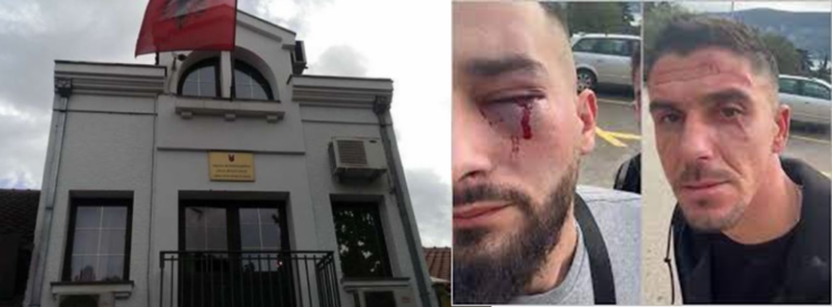 Tre shqiptarë u dhunuan në Malin e Zi, policia: U rikthyen në Atdhe!