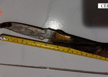 Plagosi me mjet prerës të riun, pranga 51-vjeçarit në Çërrik