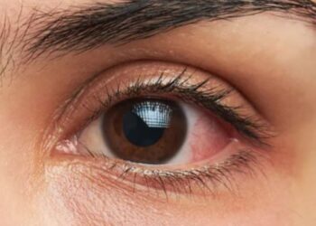 Çfarë e përcakton ngjyrën e syve, a mund të ndryshojë ajo…?