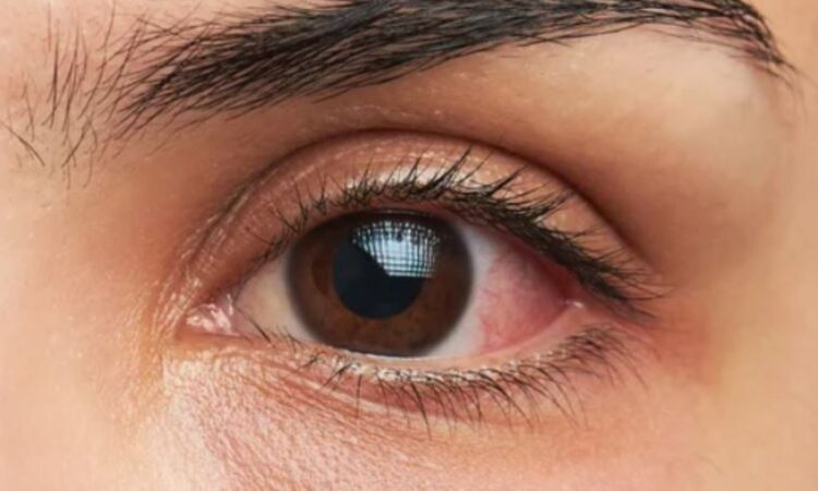 Çfarë e përcakton ngjyrën e syve, a mund të ndryshojë ajo…?