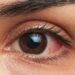 Çfarë e përcakton ngjyrën e syve, a mund të ndryshojë ajo…?